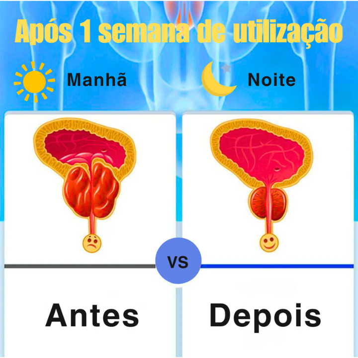 Cuidados Com a Próstata Inalador de Terapia Nasal